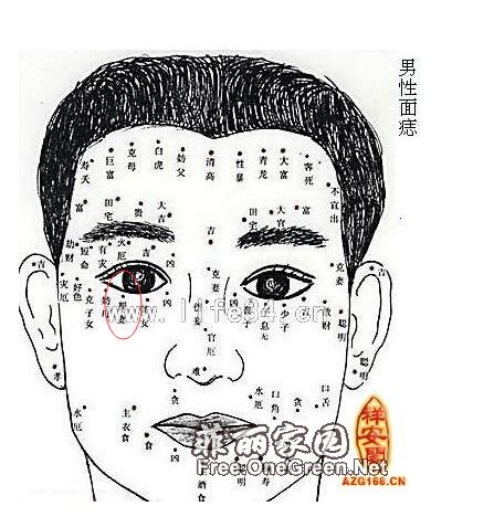 妨妻痣|妨妻痣是什么意思 妨妻痣怎么化解